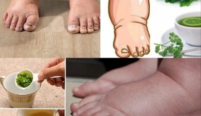 Drink this tea and you will never have swollen legs, ankles or feet again