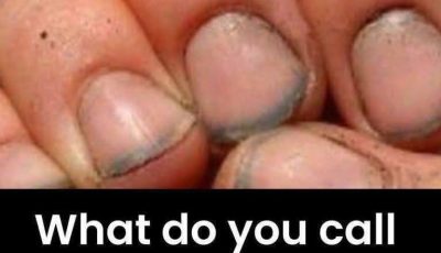 What do you call a person who has nails like that?