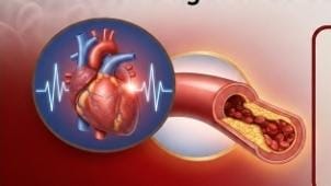 High Cholesterol No More: Natural Ways to Support Heart Health and Improve Cholesterol Levels